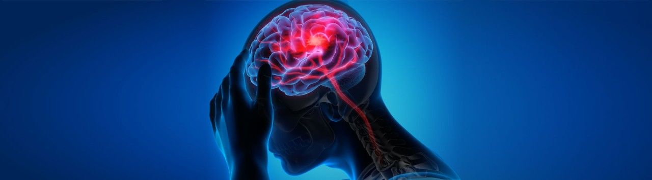 When Stroke Symptoms Appear, “BE FAST”