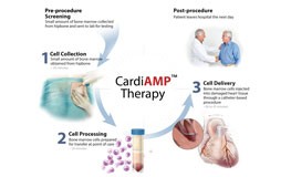 CardiAMP Therapy