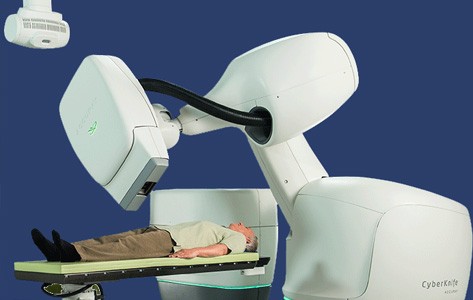 CyberKnife® stereotactic radiosurgery treatment