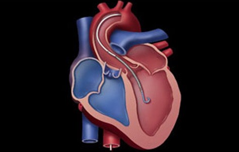 Diagram of the heart