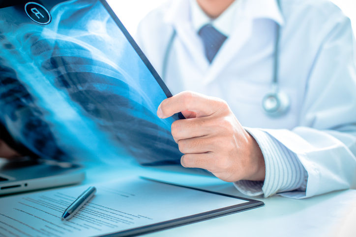 Physician examines a chest X-ray while sitting at his desk.