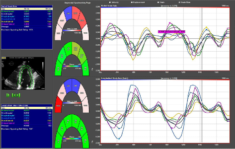 Echocardiographic Image Example