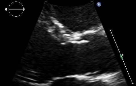 Echocardiographic Image