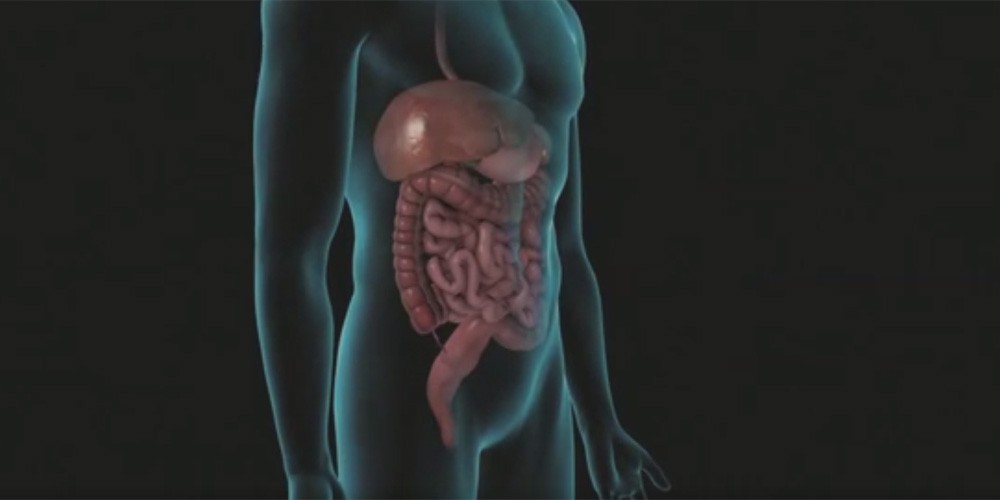 diverticular disease