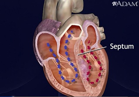 Anatomy example